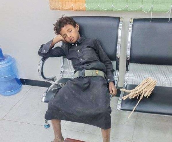#طفل_المساويك.. صورة تتصدر الترند في اليمن